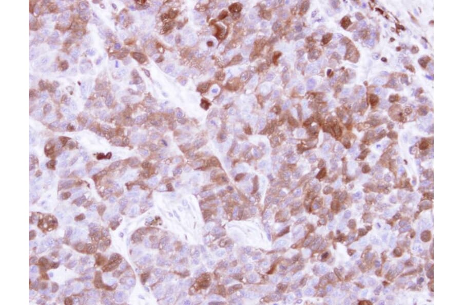Immunohistochemistry - Factor XIIIa antibody from Signalway Antibody (22995) - Antibodies.com