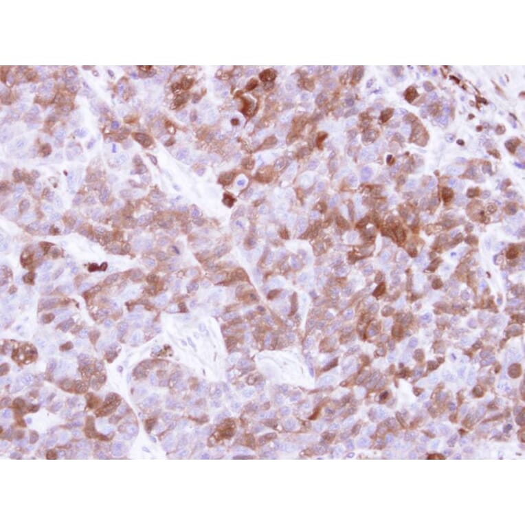 Immunohistochemistry - Factor XIIIa antibody from Signalway Antibody (22995) - Antibodies.com