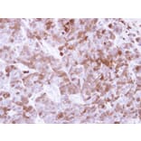 Immunohistochemistry - Factor XIIIa antibody from Signalway Antibody (22995) - Antibodies.com