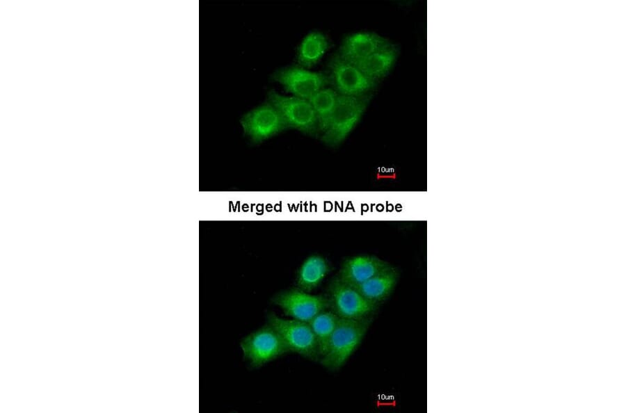 Immunofluorescence - Factor XIIIa antibody from Signalway Antibody (22995) - Antibodies.com