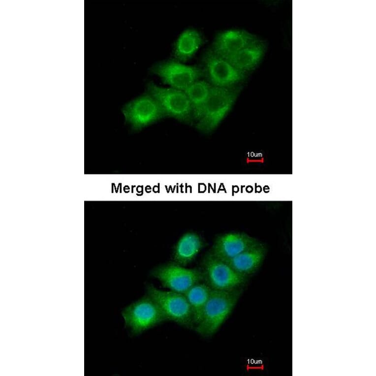 Immunofluorescence - Factor XIIIa antibody from Signalway Antibody (22995) - Antibodies.com