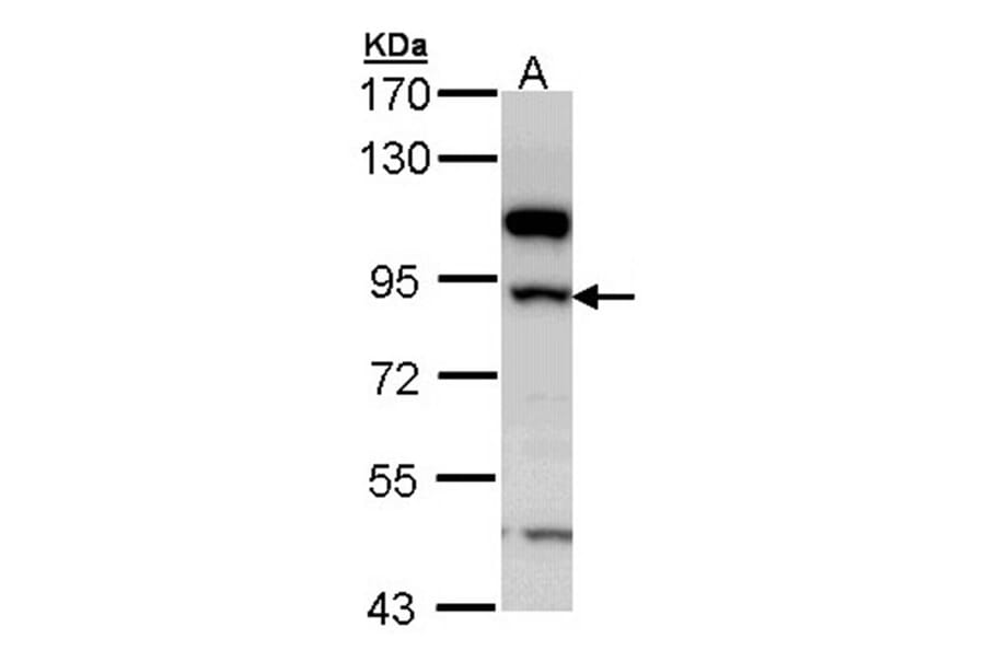 17beta-HSD4 antibody from Signalway Antibody (23020) - Antibodies.com