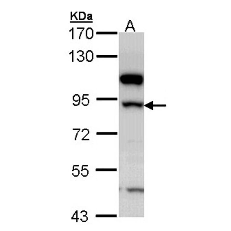 17beta-HSD4 antibody from Signalway Antibody (23020) - Antibodies.com