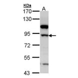 17beta-HSD4 antibody from Signalway Antibody (23020) - Antibodies.com