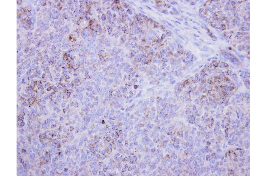Immunohistochemistry - 17beta-HSD4 antibody from Signalway Antibody (23020) - Antibodies.com