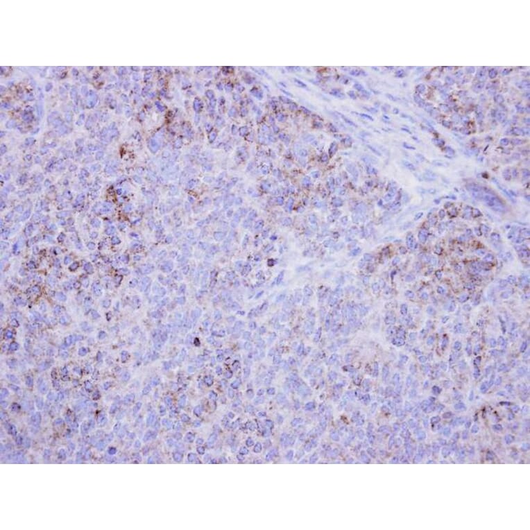Immunohistochemistry - 17beta-HSD4 antibody from Signalway Antibody (23020) - Antibodies.com