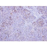 Immunohistochemistry - 17beta-HSD4 antibody from Signalway Antibody (23020) - Antibodies.com