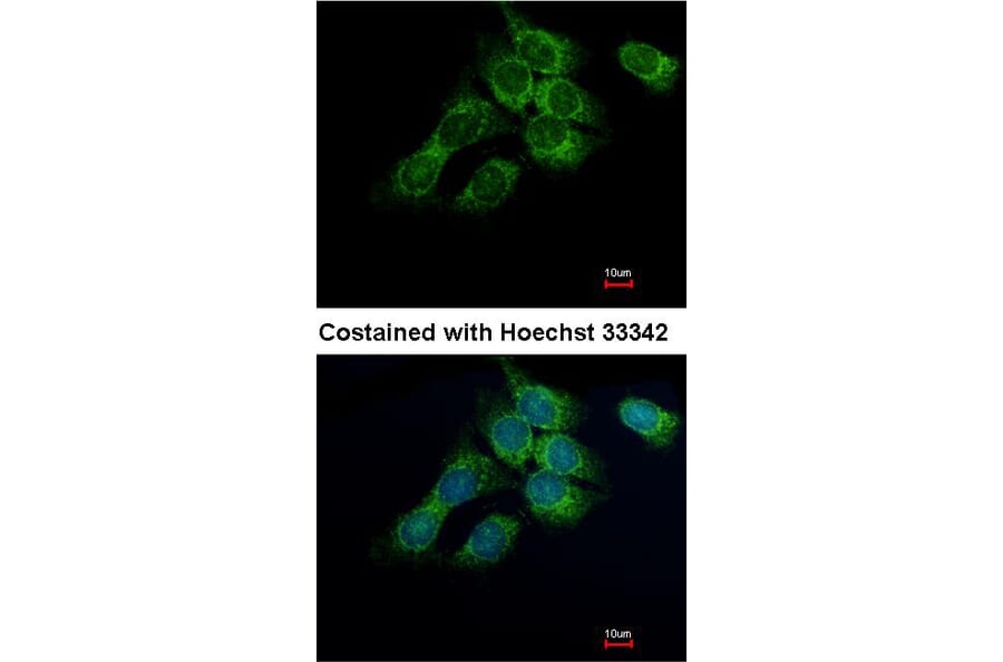 Immunofluorescence - 17beta-HSD4 antibody from Signalway Antibody (23020) - Antibodies.com