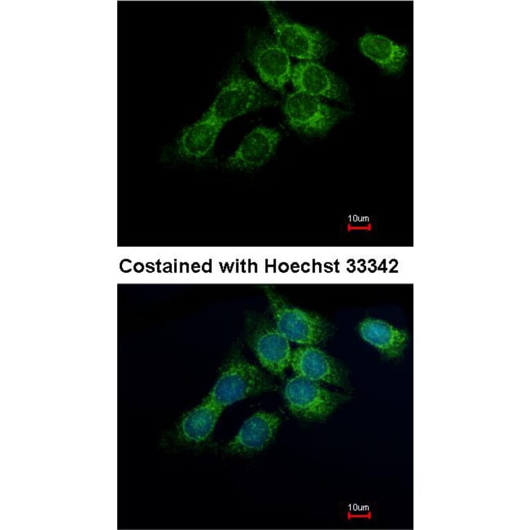 Immunofluorescence - 17beta-HSD4 antibody from Signalway Antibody (23020) - Antibodies.com