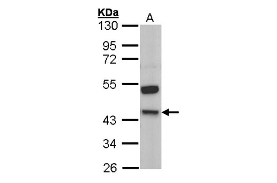 Kininogen LC antibody from Signalway Antibody (23031) - Antibodies.com