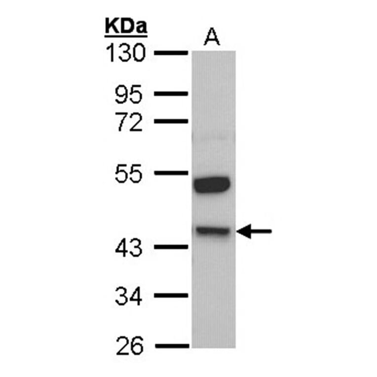 Kininogen LC antibody from Signalway Antibody (23031) - Antibodies.com
