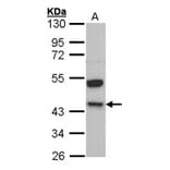Kininogen LC antibody from Signalway Antibody (23031) - Antibodies.com