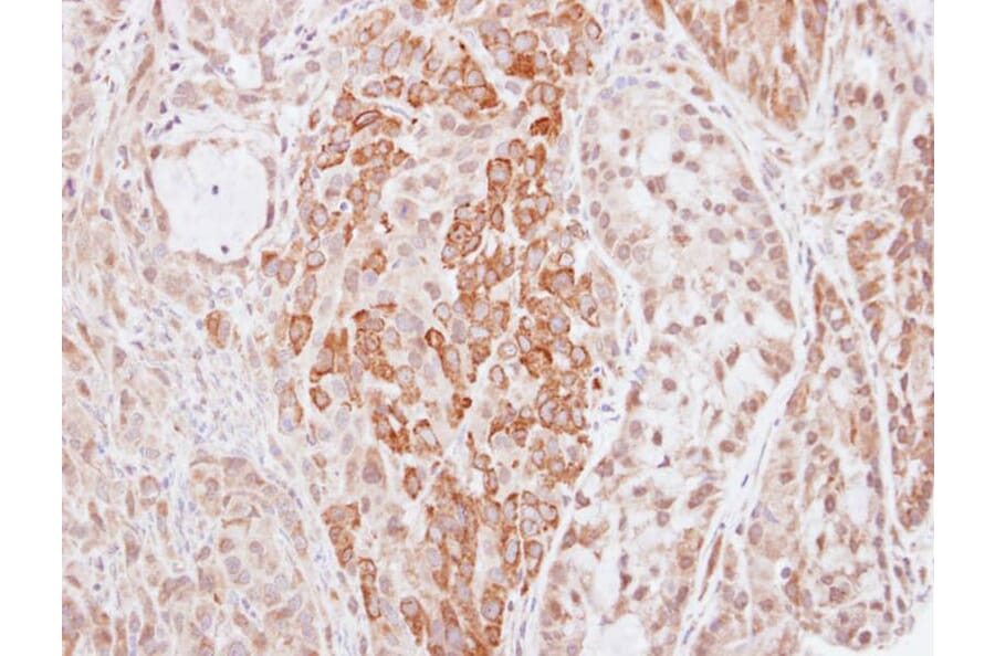 Immunohistochemistry - Kininogen LC antibody from Signalway Antibody (23031) - Antibodies.com
