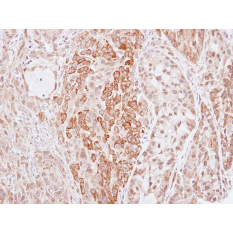 Immunohistochemistry - Kininogen LC antibody from Signalway Antibody (23031) - Antibodies.com