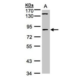 LIM kinase 2 antibody from Signalway Antibody (23035) - Antibodies.com