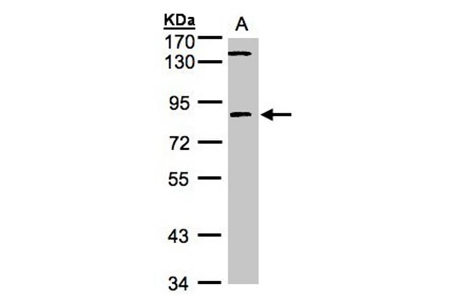 LIM kinase 2 antibody from Signalway Antibody (23035) - Antibodies.com