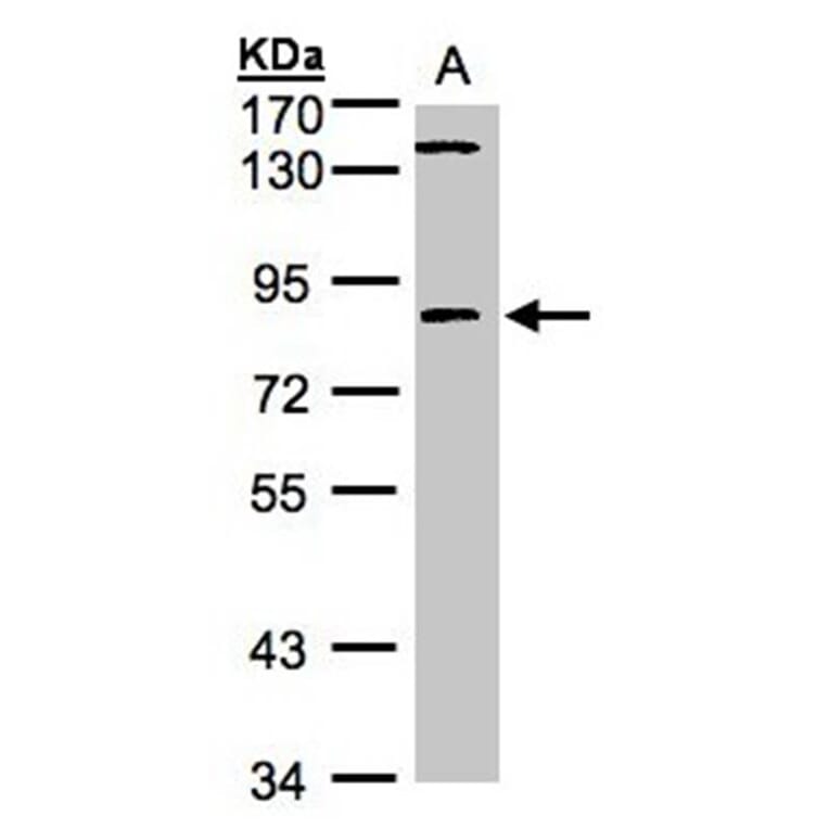 LIM kinase 2 antibody from Signalway Antibody (23035) - Antibodies.com