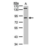 LIM kinase 2 antibody from Signalway Antibody (23035) - Antibodies.com