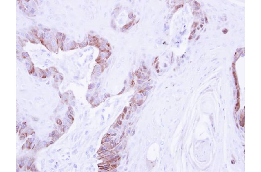 Immunohistochemistry - LIM kinase 2 antibody from Signalway Antibody (23035) - Antibodies.com