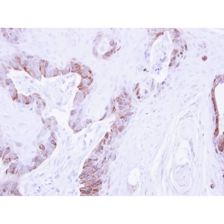 Immunohistochemistry - LIM kinase 2 antibody from Signalway Antibody (23035) - Antibodies.com