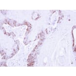 Immunohistochemistry - LIM kinase 2 antibody from Signalway Antibody (23035) - Antibodies.com