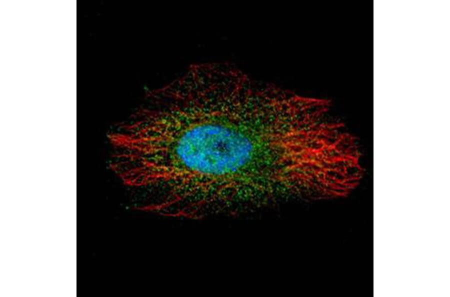 LIM kinase 2 antibody from Signalway Antibody (23035) - Antibodies.com