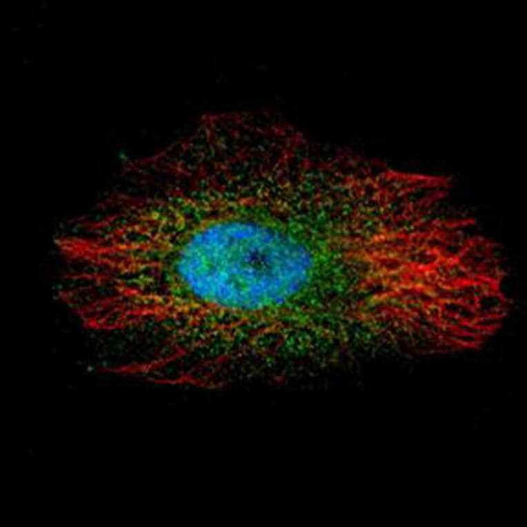 LIM kinase 2 antibody from Signalway Antibody (23035) - Antibodies.com