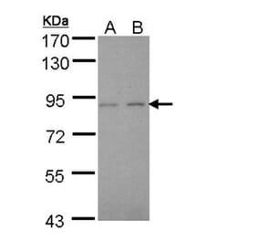 LIM kinase 2 antibody from Signalway Antibody (23036) - Antibodies.com