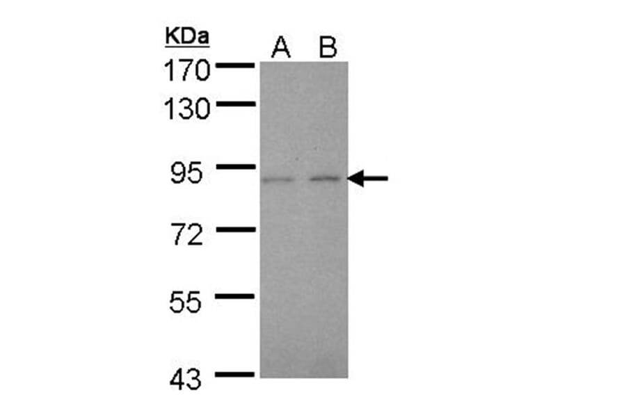 LIM kinase 2 antibody from Signalway Antibody (23036) - Antibodies.com