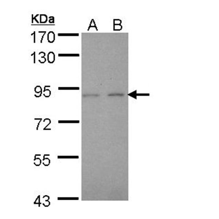 LIM kinase 2 antibody from Signalway Antibody (23036) - Antibodies.com
