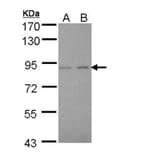 LIM kinase 2 antibody from Signalway Antibody (23036) - Antibodies.com