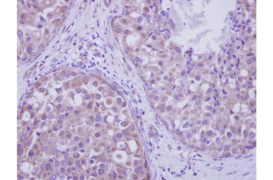 Immunohistochemistry - LIM kinase 2 antibody from Signalway Antibody (23036) - Antibodies.com