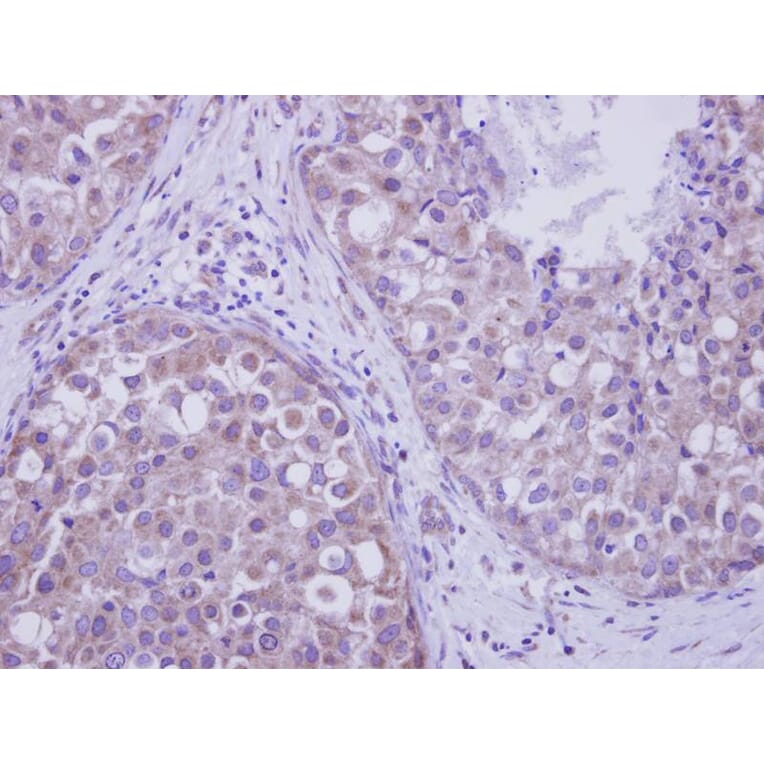 Immunohistochemistry - LIM kinase 2 antibody from Signalway Antibody (23036) - Antibodies.com