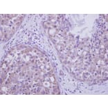 Immunohistochemistry - LIM kinase 2 antibody from Signalway Antibody (23036) - Antibodies.com