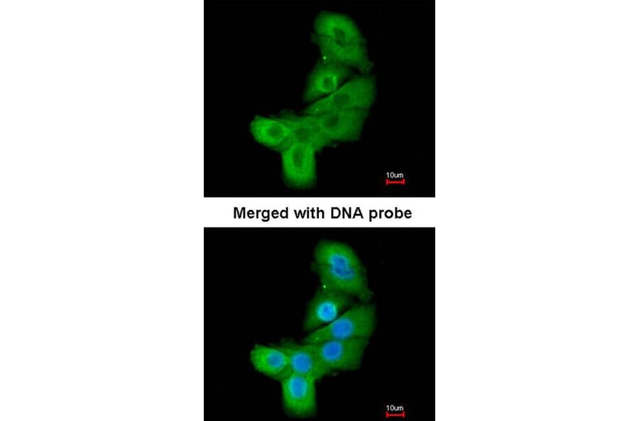 Immunofluorescence - LIM kinase 2 antibody from Signalway Antibody (23036) - Antibodies.com