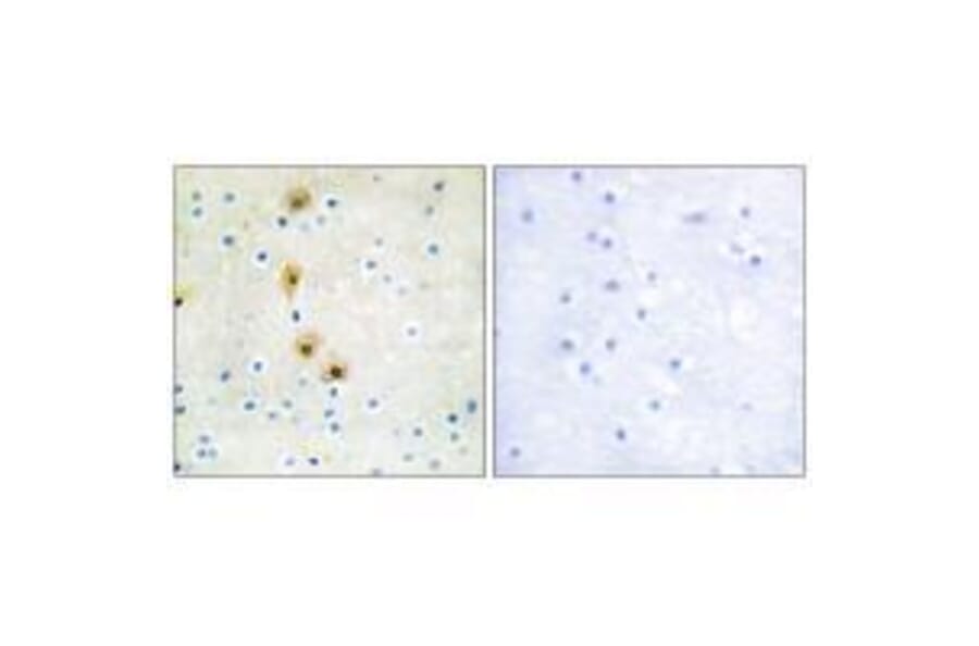 Immunohistochemistry - Akt (Ab-326) Antibody from Signalway Antibody (33152) - Antibodies.com