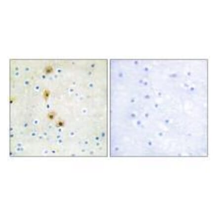 Immunohistochemistry - Akt (Ab-326) Antibody from Signalway Antibody (33152) - Antibodies.com