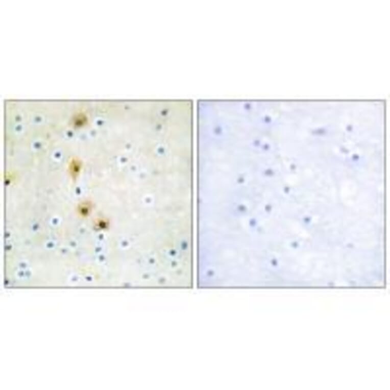 Immunohistochemistry - Akt (Ab-326) Antibody from Signalway Antibody (33152) - Antibodies.com