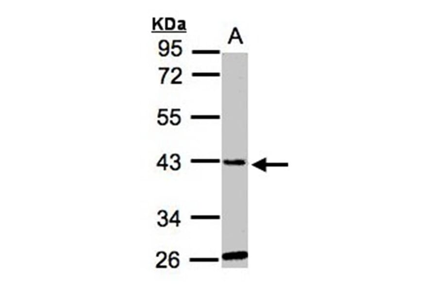glycine-N-acyltransferase-like 1 antibody from Signalway Antibody (22121) - Antibodies.com