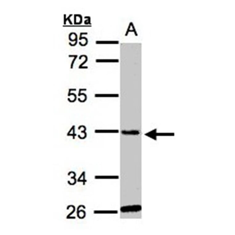 glycine-N-acyltransferase-like 1 antibody from Signalway Antibody (22121) - Antibodies.com