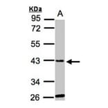 glycine-N-acyltransferase-like 1 antibody from Signalway Antibody (22121) - Antibodies.com