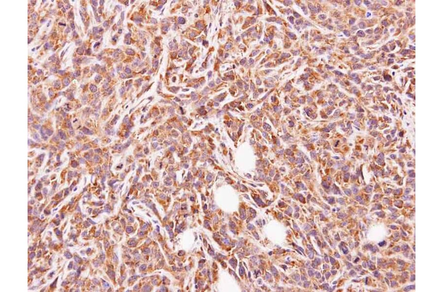Immunohistochemistry - glycine-N-acyltransferase-like 1 antibody from Signalway Antibody (22121) - Antibodies.com