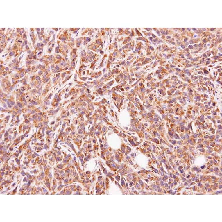Immunohistochemistry - glycine-N-acyltransferase-like 1 antibody from Signalway Antibody (22121) - Antibodies.com