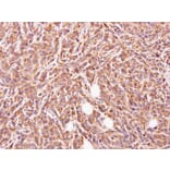 Immunohistochemistry - glycine-N-acyltransferase-like 1 antibody from Signalway Antibody (22121) - Antibodies.com