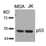 Western blot - p53 (Ab-15) Antibody from Signalway Antibody (21085) - Antibodies.com