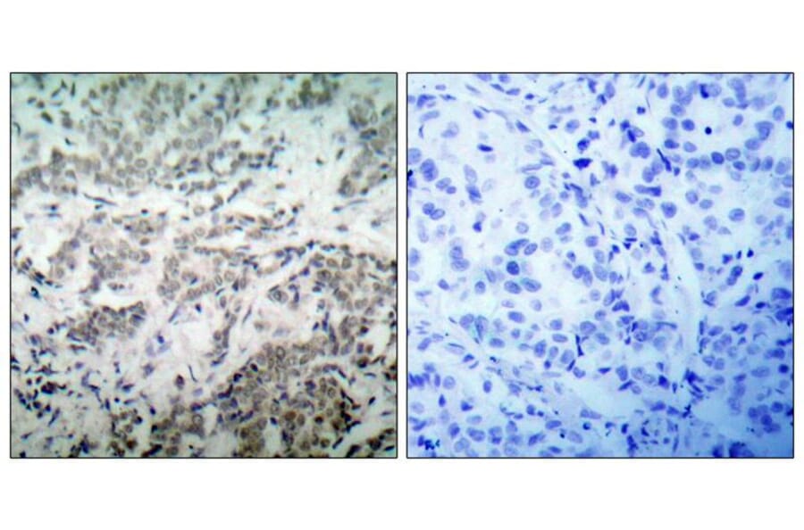 Immunohistochemistry - p53 (Ab-15) Antibody from Signalway Antibody (21085) - Antibodies.com