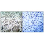 Immunohistochemistry - p53 (Ab-15) Antibody from Signalway Antibody (21085) - Antibodies.com