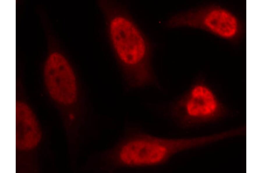 Immunofluorescence - p53 (Ab-15) Antibody from Signalway Antibody (21085) - Antibodies.com