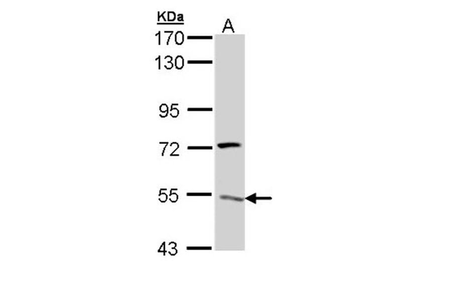 V-ATPase H antibody from Signalway Antibody (22086) - Antibodies.com
