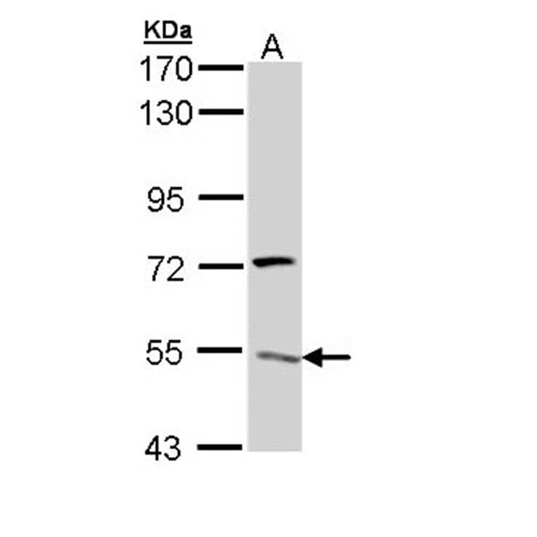 V-ATPase H antibody from Signalway Antibody (22086) - Antibodies.com